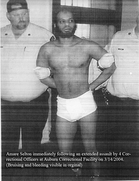 Amare Selton Beaten at Auburn Correctional Facility